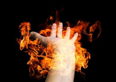 Types and Degrees of Burn Injuries